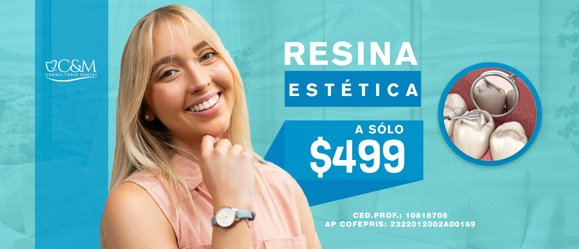 Resinas estéticas